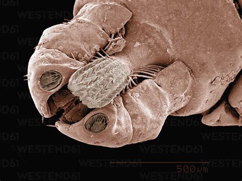 Mouthparts Of A Dog Tick Acari Dermacentor Sp Imaged In A Scanning