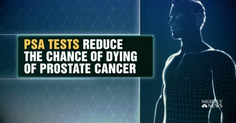 New Guidelines For Prostate Cancer Screenings