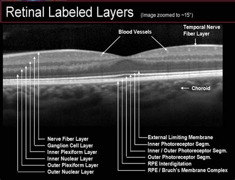 Layers Of The Retina Oct Oct Retinal Layers Eye Facts Optometry