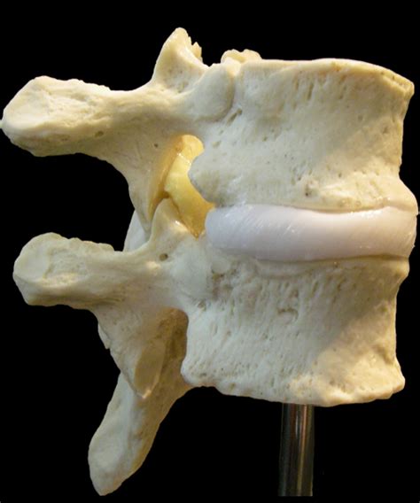 Full Set Of Thoracic Spine Models Scientific And Thoracic Vertebrae Model