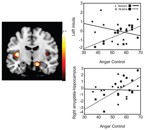 Gene Brain Behavior Model In Anger Control Left Panel Image Of The