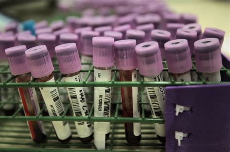 With Better Hiv Tests Should Fda End Its Ban On Gay Men Donating Blood