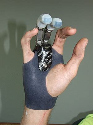 Somatic Finger Hand Prosthetics Medical Art Prosthetics