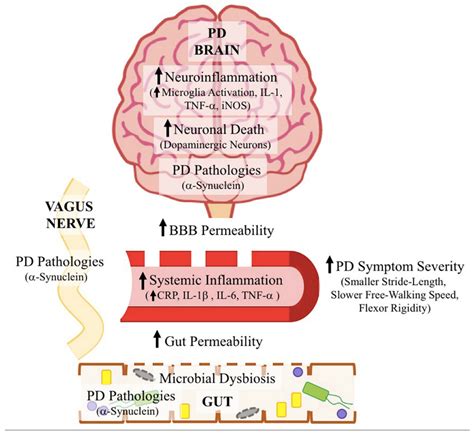 There are two main rating scales that describe the stages of parkinson's and. Parkinson Disease Stages Death - minimalistisches Interieur
