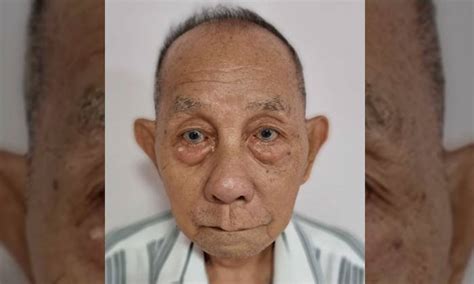 Found Police Appealing For Info On 83 Year Old Man Last Seen At Compassvale Street
