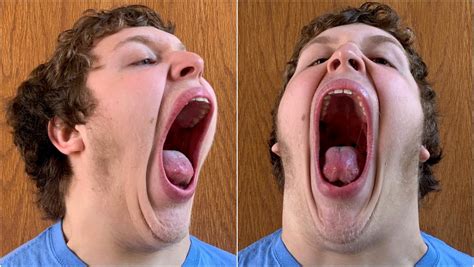 ペンシルベニア州の少年が 口の大きさ でギネス世界記録に認定！ ギネス世界記録