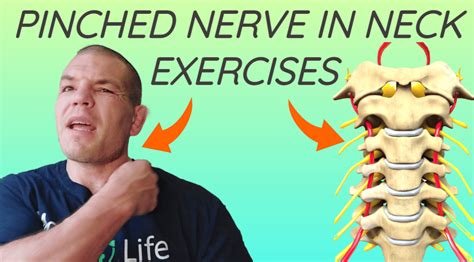 Pinched Nerve In Neck Exercises Relieve Pinched Nerve Pain