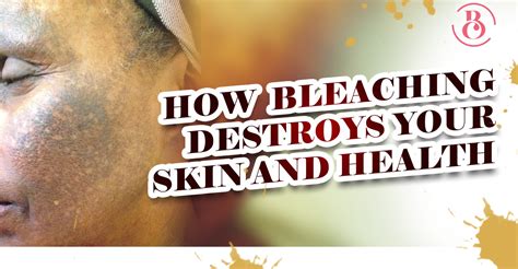 5 Ways Bleaching Destroys Your Skin And Health Beaucrest