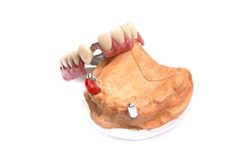 Proteza górna Protetyka i Stomatologia DL dent s c Jasło