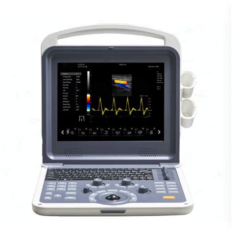 China Medical Portable 4d Full Digital Color Doppler B Ultrasound