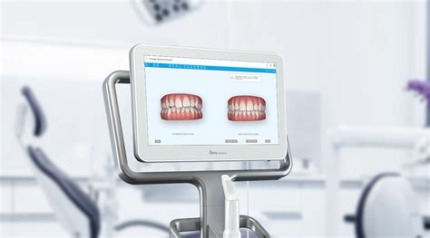 Itero 3d Digital Scanner Preview Your Smile Orthodontics By Jackie