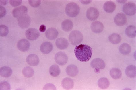 Plasmodium Vivax Microgametocyte