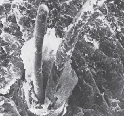 During catagen, cells in the follicle wall undergo apoptosis and the hair follicle regresses upward so that the dermal papilla contacts the bulge. Do multiple hairs grow out of a single follicle? Or one ...
