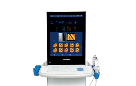 Fibroscan® The Non Invasive Solution For Liver Disease Echosens