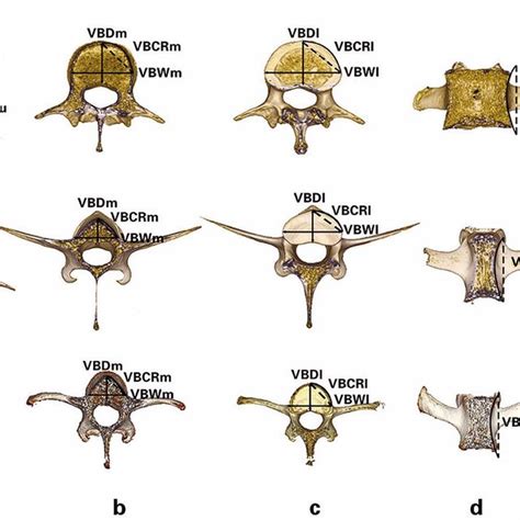 Pdf Anatomical Characteristics Of Deer And Sheep Lumbar Spines