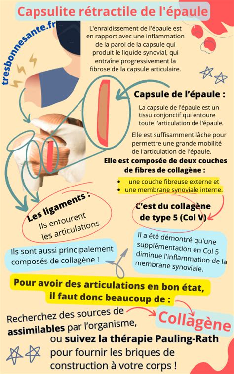 Capsulite De L Paule Des Livres Des Infos Et Des Produits Qui