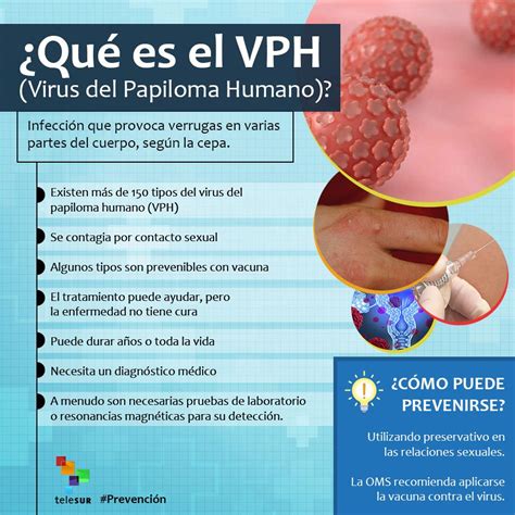 Conoce Prevenci N Conoce Los S Ntomas Del Vph En El Cuerpo Y C Mo Se