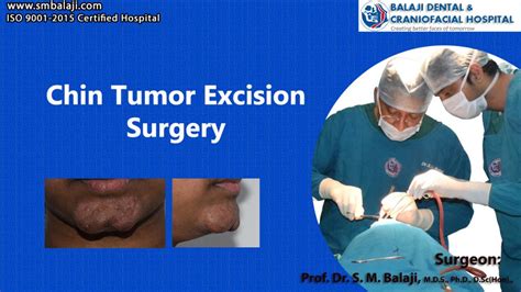 Chin Tumor Excision Surgery Dr Sm Balaji Maxillofacial Surgeon
