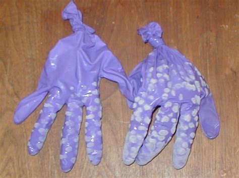 A septoplasty, essentially a surgery to repair a crooked nose, has distinct implications for the patient's overall health. Septoplasty