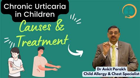 Chronic Urticaria In Children Causes And Treatment I Dr Ankit Parakh