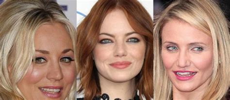8 Celebrities Talk About Their Struggle With Acne Women Daily Magazine