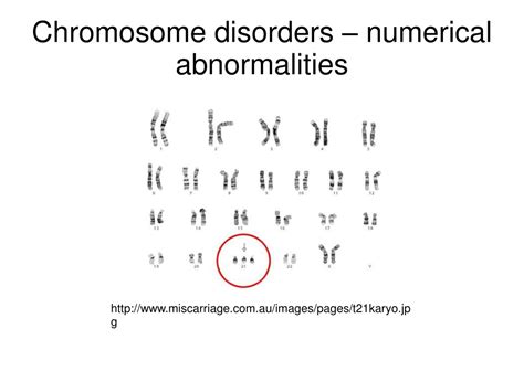 PPT Chromosome Disorders Numerical Abnormalities PowerPoint