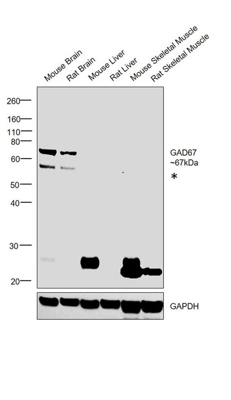 Gad67 Monoclonal Antibody Gt1982 Ma5 27817