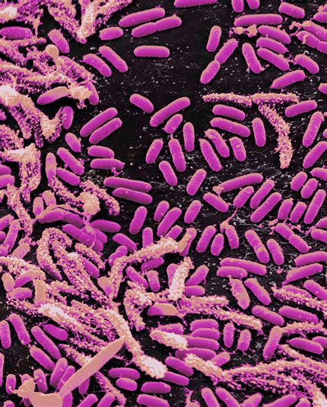 Vibrio Bacteria Sem 1 Photograph By Science Source Pixels