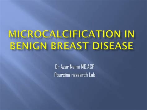 Ppt Microcalcification In Benign Breast Disease Powerpoint Presentation Id