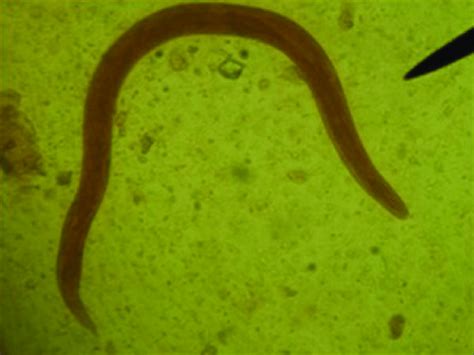 The Identification Of A Filariform Larva Of Ancylostoma Caninum