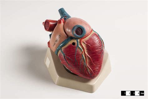 Living Heart Project Develops ‘walk In Heart Simulation To Aid
