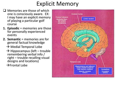 Explicit Memory Gallery