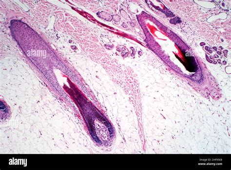 Human Scalp And Hair Follicle Light Micrograph Stock Photo Alamy