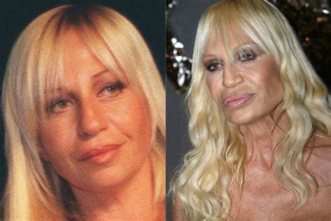 These Celebs Just Wanted A Babe Plastic Surgery The Results Horrifying Bad Plastic