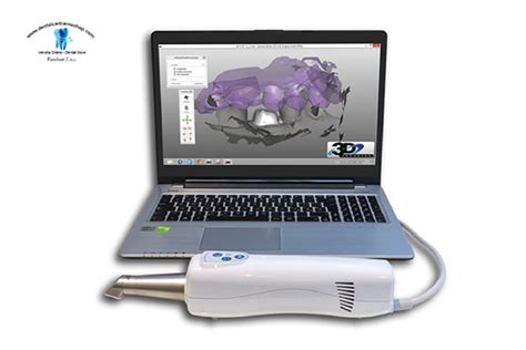 Body scanner metal detector is a measuring tool to find out iron and metal based items in human body. 3D Progress Intraoral Scanner review - 3D scanner