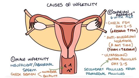 Understanding Infertility Causes And Investigations Basic Anatomy And