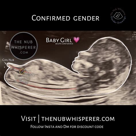 Baby Girl Gender Prediction Nub Theory How To Find Out