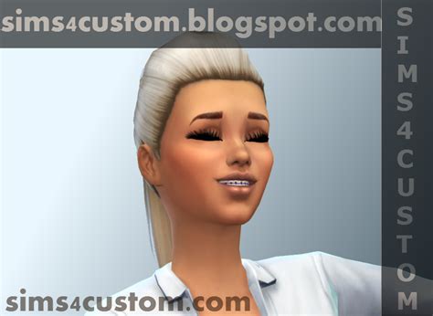 Female Male Teeth Braces Accessory Set The Sims 4 Sims 4 Custom