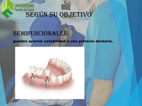 Ppt Cirugía Oral Powerpoint Presentation Free Download Id6506547