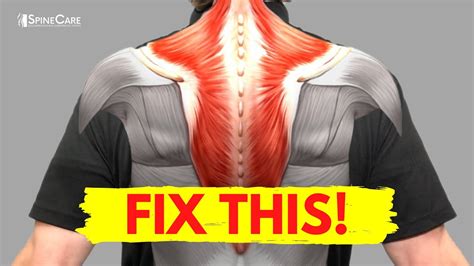 How To Fix Muscle Knots In Your Neck And Shoulder In SECONDS YouTube