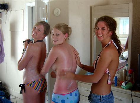 Do You Have Sunburn Or Are You Always This Hot Porn Pic