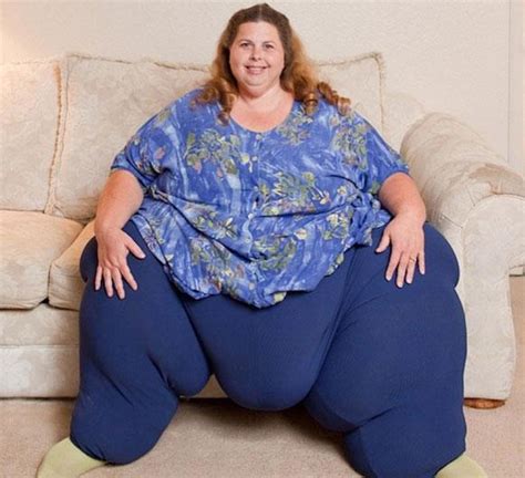 Arriba Foto Porque Tengo Las Piernas Flacas Y El Cuerpo Gordo Mujer Actualizar