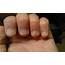 Horizontal Dent In Fingernail  How You Can Do It At Home Pictures