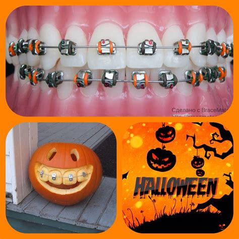 Get Ready For Halloween Orthodontics Braces Brackets Ortodoncia Braceslife Pumpkin