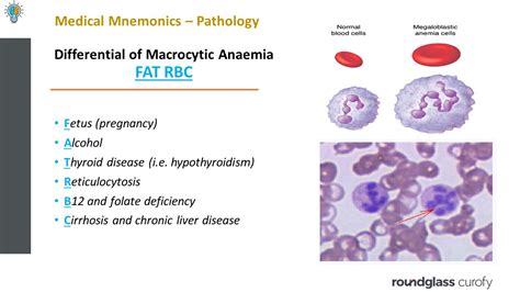 Differential Diagnosis Of Macrocytic Anaemia