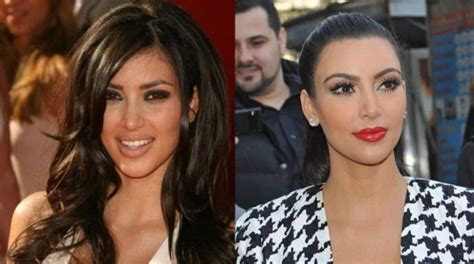 Kim Kardashian Plastic Surgery Before And After Nose Job Botox And