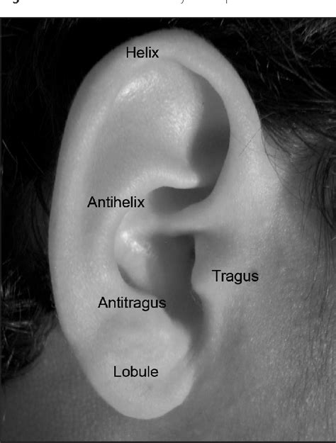 Figure 20 From Sonography Of The Ear Pinna Semantic Scholar