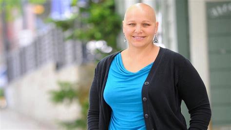 Living With Alopecia Skagit Woman Faces Baldness Head On With New Book
