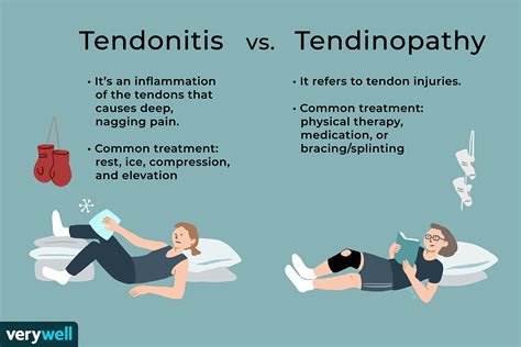 Tendonitis And Tendinopathy