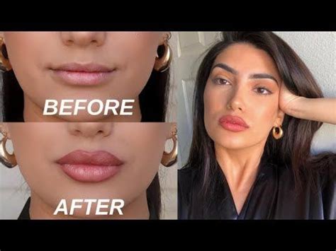 How To Get Big Lips Naturally Without Lip Fillers Or Surgery Get Full Lips Like Kylie With